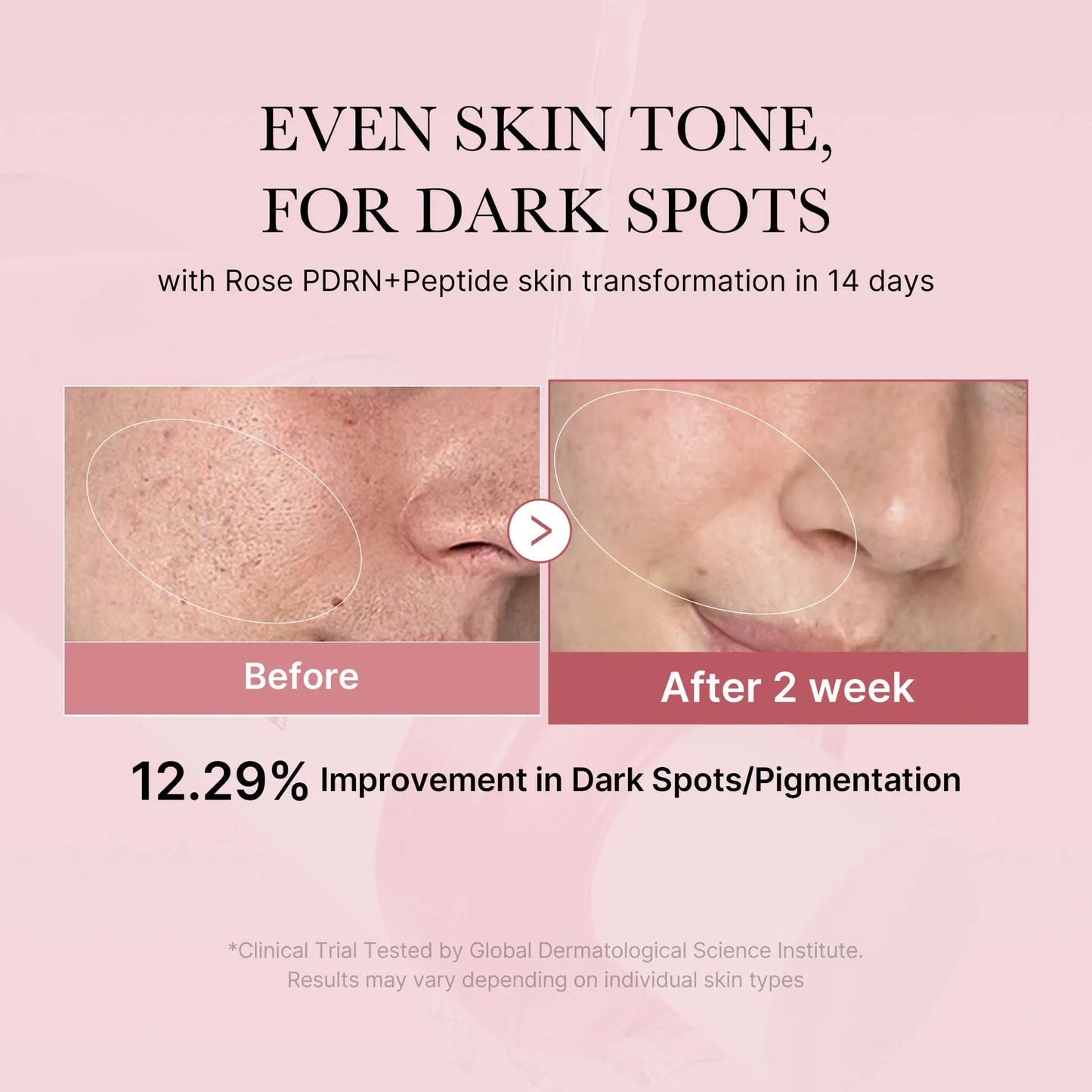 PDRN Pink Peptide Toner 250ml
