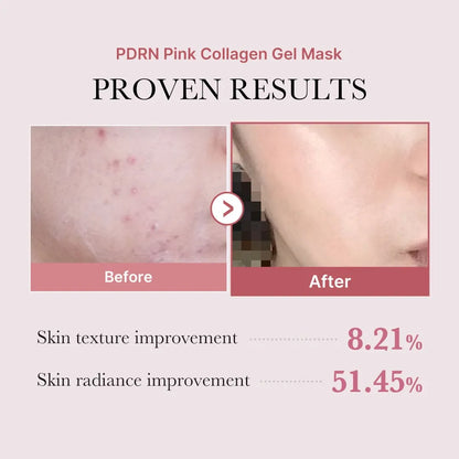 PDRN Pink Collagen Gel Mask 4 Sheets Salmon DNA Color Changing Pink Glow Collagen Facial Mask Korean Skincare